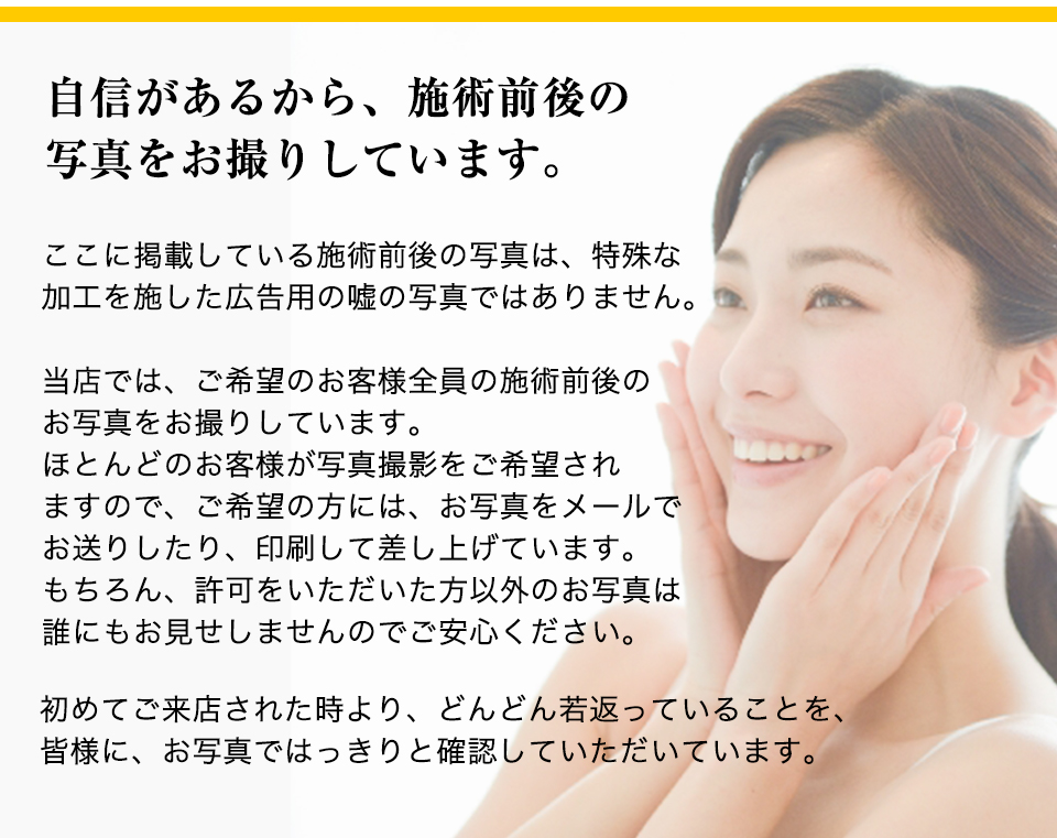 自信があるから、施術前後の写真をお撮りしています。